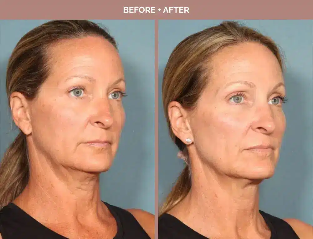 1762443651_f3a76bd2ae374fbebd3834e9bdc1d4a3 1762443651 f3a76bd2ae374fbebd3834e9bdc1d4a3 1