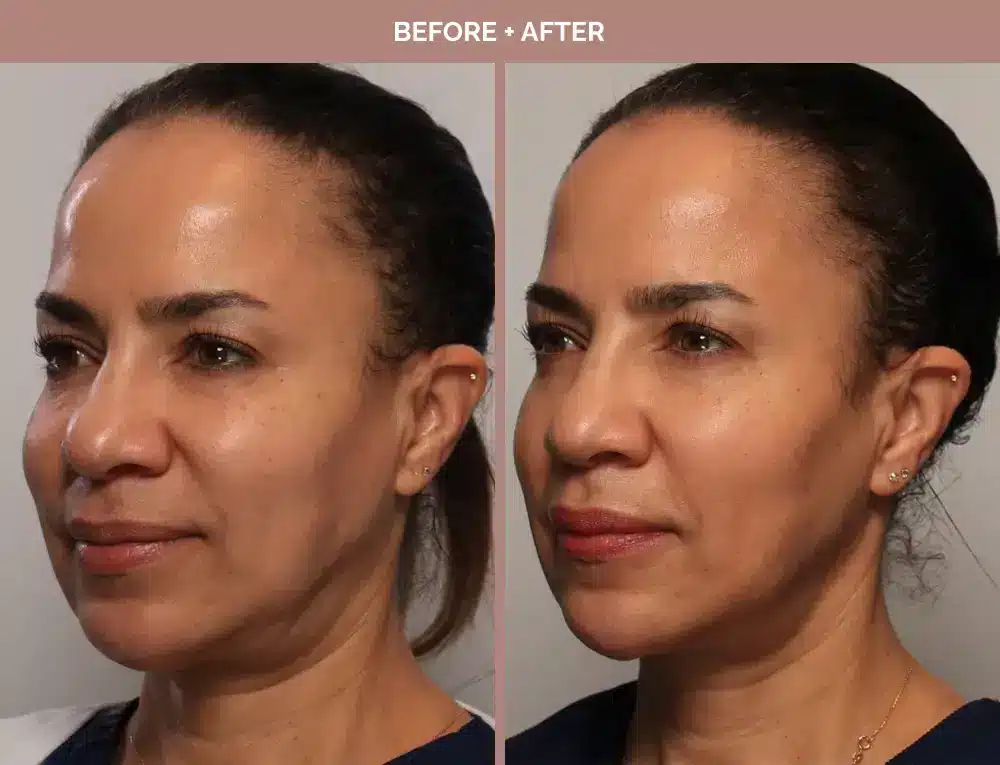 1762443655_2d3a57bd88c14c18a1f7950ace9357ab 1762443655 2d3a57bd88c14c18a1f7950ace9357ab 1