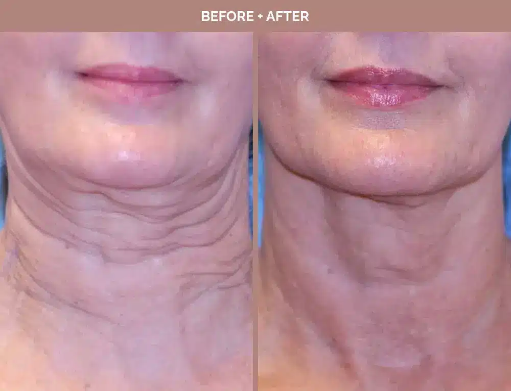 1762443658_a4f652d65fc2434093a516f3addef63e 1762443658 a4f652d65fc2434093a516f3addef63e 1