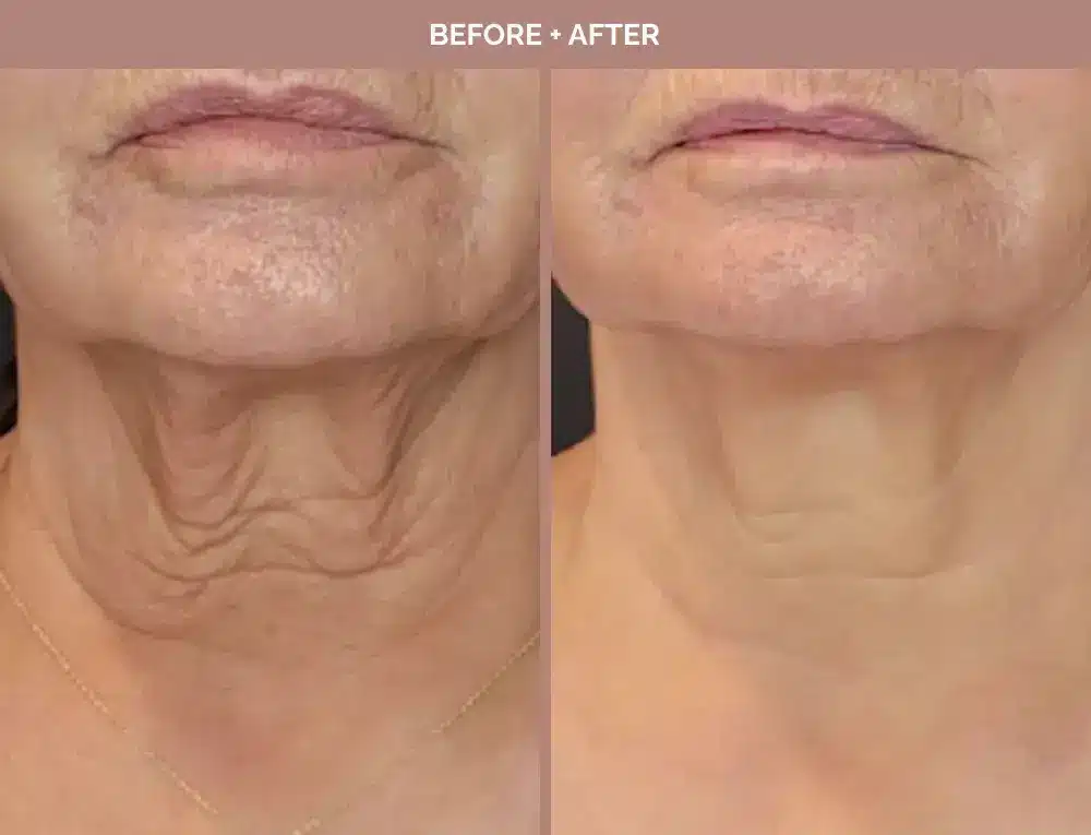 1762443661_c18a5a7de61b4e3188a9103e58c62c66 1762443661 c18a5a7de61b4e3188a9103e58c62c66 1