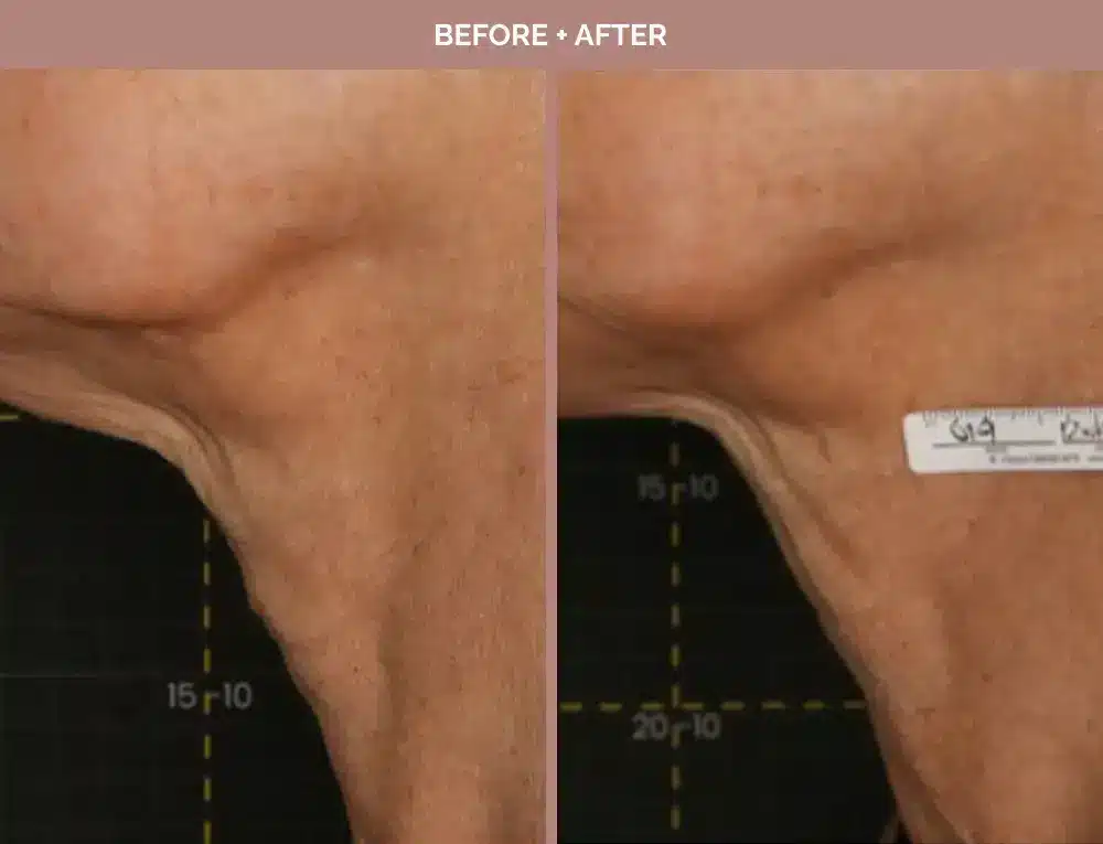 1762443665_97be6cc7a2854099b0d3870c56fd1b71 1762443665 97be6cc7a2854099b0d3870c56fd1b71 1