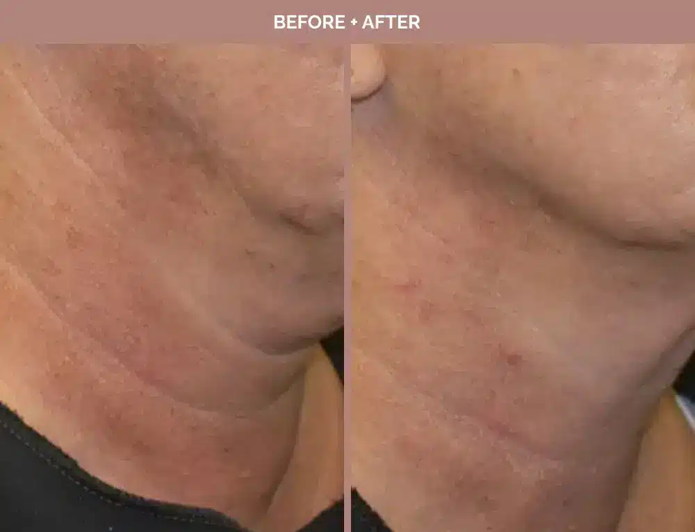 1762443668_d93b3d81d3cd4739ae964dbccb6e55d9 1762443668 d93b3d81d3cd4739ae964dbccb6e55d9 1